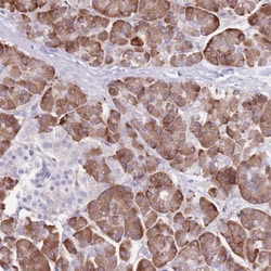 DET1 Antibody, Novus Biologicals:Antibodies:Primary Antibodies